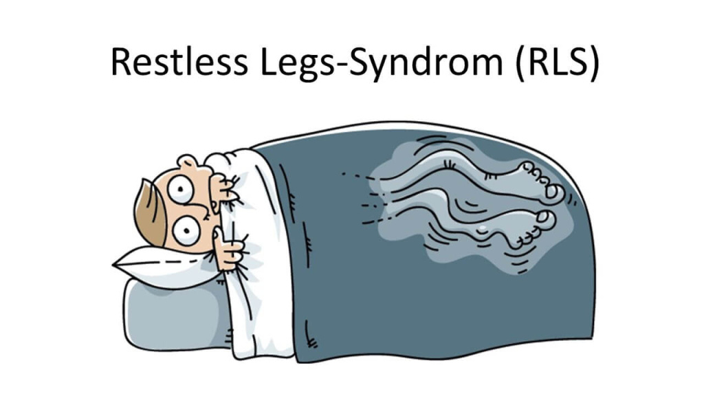 Man in Bed with Restless Legs, Illustrating Restless Legs Syndrome.